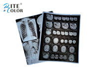 パックごとのDR CT 100シートのためのペット基盤X光線のカット フィルムの放射線学イメージ投射フィルム