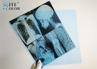 インクジェット青い放射線学の医用画像処理のフィルム