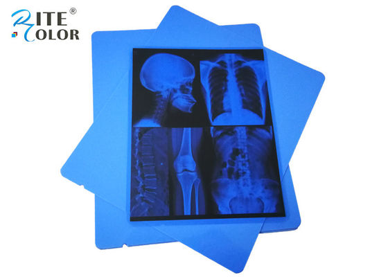 13のx 17インチの医用画像処理のフィルム ペット青いインクジェットX線の放射線学