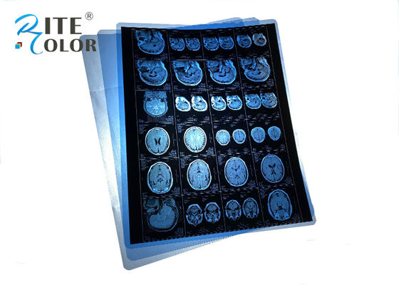 防水PETブルー医療用X線フィルム MRI CT CR 歯科パノラマ画像出力